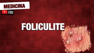 Foliculite bactéria causadora patologia e tratamento [upl. by Jess581]