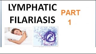 Parasitology 221 a Wuchereria Bancrofti Filariasis Filarial worm Elephantiasis Culex Microfilaria [upl. by Eizus301]