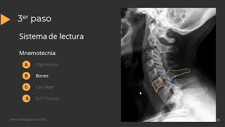 Radiografía de Columna Paso a Paso [upl. by Egidio]