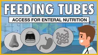 Types of Feeding Tubes EXPLAINED [upl. by Leumhs]