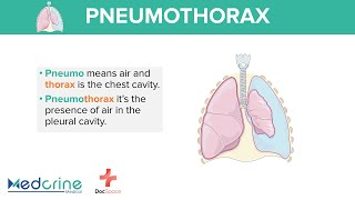 Pneumococcal Vaccination for Elderly People  Video [upl. by Runck]