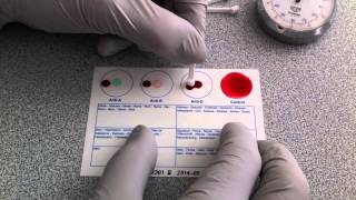 Blood Typing Using EldonCard HD [upl. by Phillie]