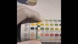 UTI dipstick test Urine Analysis [upl. by Alonso]