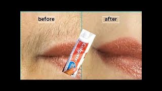 In 5 Minutes Remove Unwanted Hair  Effective Hair Removal [upl. by Aryajay]