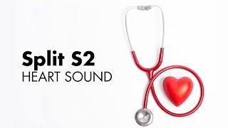 Fixed Split S2  Heart Sounds  MEDZCOOL [upl. by Yelnek235]