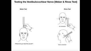 Interpreting the WeberRinne Tests EXPLAINED [upl. by Lebam]