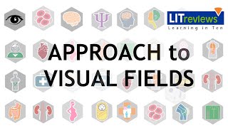 Neurology Exam Visual Fields [upl. by Annoya]