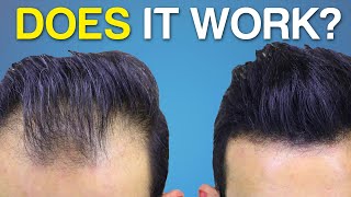 Does Hair Fiber SPRAY Work BETTER Hair Coverage [upl. by Barry771]