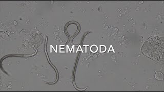 Nematodes [upl. by Nodla]