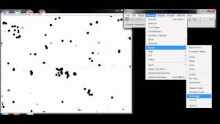 Counting Cells with ImageJ [upl. by Sylram]