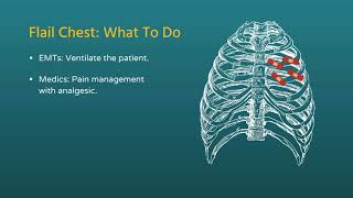 Chest Trauma Flail Chest [upl. by Khanna]