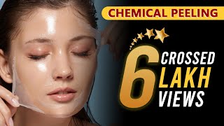 Peels 101  How to apply a chemical peel [upl. by Onavlis311]