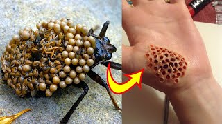 Top 10 Insectos Y Arácnidos Más Peligrosos Del Mundo [upl. by Cramer]