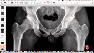 Pelvis and Hips Essential Radiography Repost [upl. by Dunham]