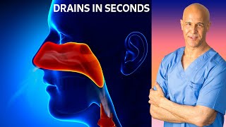 Dr Mandells Sinus Drainage Trick [upl. by Castle]