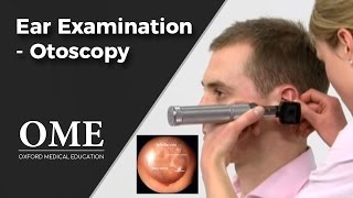 Otoscopy Ear Examination  ENT [upl. by Boland]