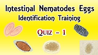 Intestinal Nematodes Eggs Identification Training Quiz 14 [upl. by Ruddie224]