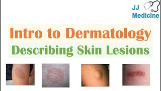 Introduction to Dermatology  The Basics  Describing Skin Lesions Primary amp Secondary Morphology [upl. by Nnitsuj]