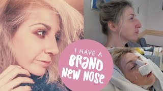 NOSE JOB VLOG  From Surgery to Recovery Rhinoplasty  Septorhinoplasty Journey [upl. by Nihs]