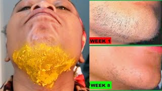 JUST 2 INGREDIENTS REMOVE FACIAL HAIR REMOVE FACIAL HAIR PERMANENTLY CHIN  UPPER LIPS [upl. by Barthol]