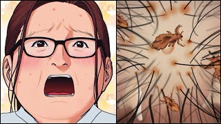 ASMR ANIMATION 😱  Head Lice Removal Animation [upl. by Tallie]