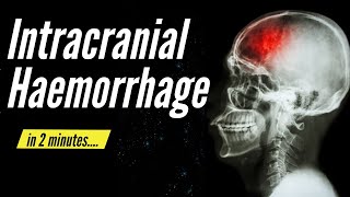 Intracranial Haemorrhage in 2 minutes [upl. by Zorah]