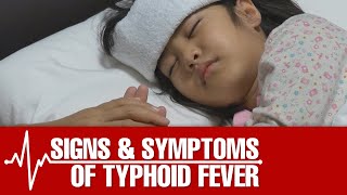 Signs and Symptoms of Typhoid Fever [upl. by Driscoll643]