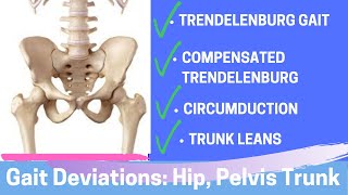 Gait Deviations Hip Pelvis Trunk [upl. by Assenov]