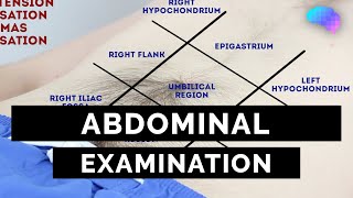 Abdominal Examination  OSCE Guide Latest  UKMLA  CPSA  PLAB 2 [upl. by Anerul]