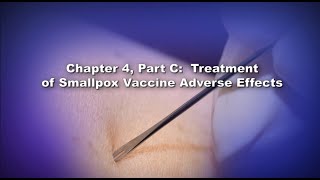 Chapter 4 Part C Treatment of Smallpox Vaccine Adverse Events [upl. by Rehptosirhc107]