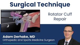 Rotator Cuff Repair Surgical Technique [upl. by Bysshe]