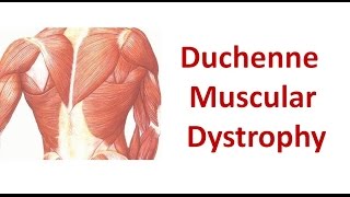 Duchenne Muscular Dystrophy [upl. by Kcin]