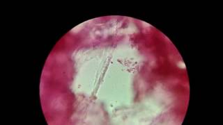 Biology Experiment  Rhizobium  The Nitrogen Fixing bacteria under Microscope [upl. by Hobie]