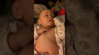 Example of Retractions Belly Breathing and Tachypnea in Infant [upl. by Leuname44]