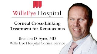 Corneal CrossLinking  Treatment for Keratoconus [upl. by Caassi]