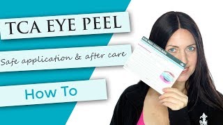 TCA Eye Peel Tutorial  Demonstration  After Care [upl. by Darleen]