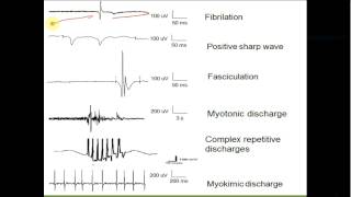 Chapter 2 part 2 Electromyography amp Evoked potentials [upl. by Niamart]