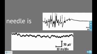 EMG and Action Potentials [upl. by Ahcorb138]