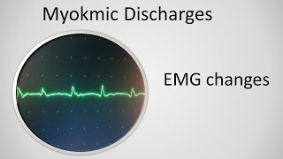 Myokymia on EMG [upl. by Essila]