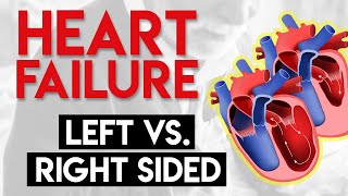 Left vs Right Heart Failure  Heart Failure Part 3 [upl. by Ojok877]