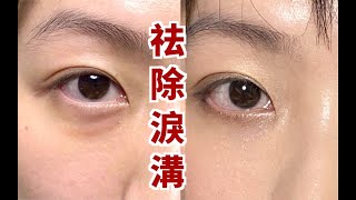 0成本按摩去淚溝眼袋  不醫美！告別遮瑕 日本爆火去淚溝按摩法來了 [upl. by Ayekat]