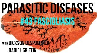 Parasitic Diseases Lectures 43 Fascioliasis [upl. by Aenotna]