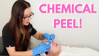 CHEMICAL PEEL AT HOME BEFORE amp AFTER EBANEL SKINCARE [upl. by Cartie573]