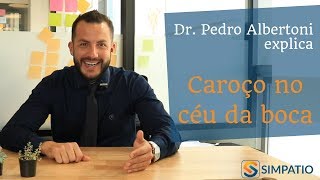 CAROÇO NO CÉU DA BOCA CONHEÇA AS CAUSAS com Dr Pedro Albertoni [upl. by Sadiras]