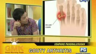 Understanding Gouty Arthritis [upl. by Boesch948]