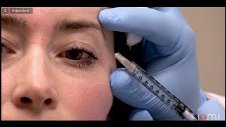 Patients Guide to Eye Injections [upl. by Durtschi996]