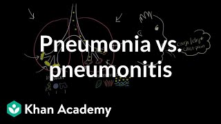 How to pronounce cephalexin Keflex Memorizing Pharmacology Flashcard [upl. by Roxanne]