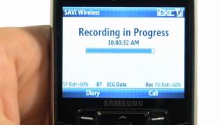 Patient Guide SAVI Wireless MCT Monitor [upl. by Estel]