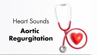 Aortic Regurgitation  Heart Sounds  MEDZCOOL [upl. by Romona]