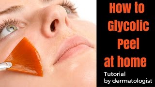 How to Glycolic Peel at HOME [upl. by Ayarahs]